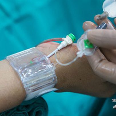 عمل آنژیوگرافی قلب