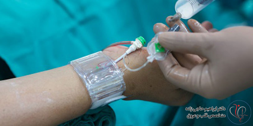 عمل آنژیوگرافی قلب