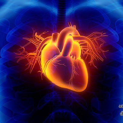 گرفتگی عروق کرونر