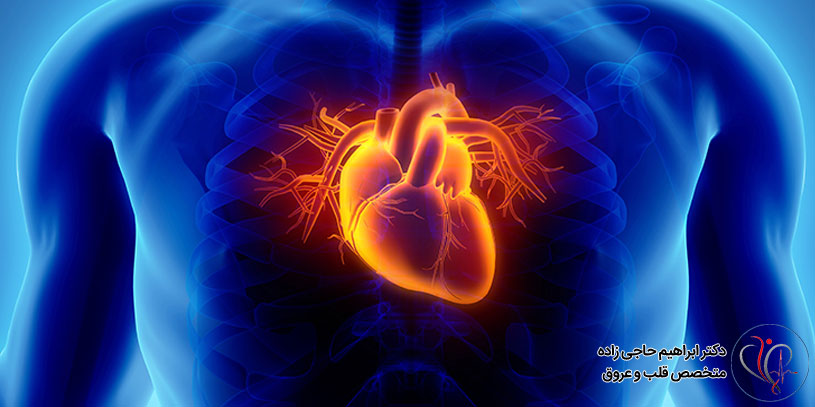 گرفتگی عروق کرونر