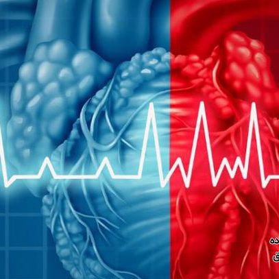 آریتمی قلبی