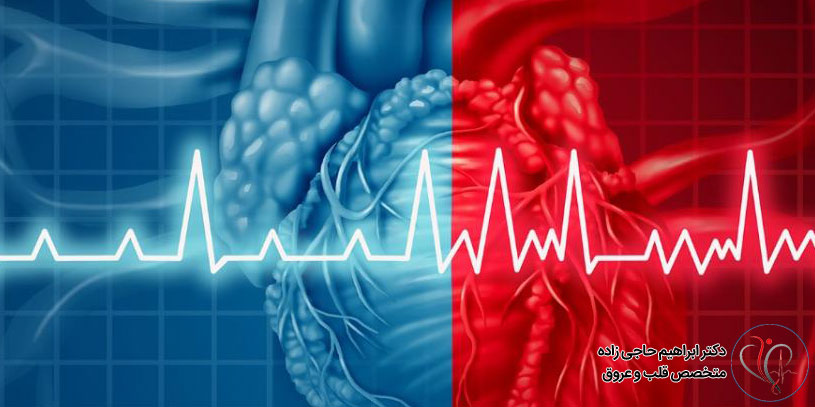 آریتمی قلبی