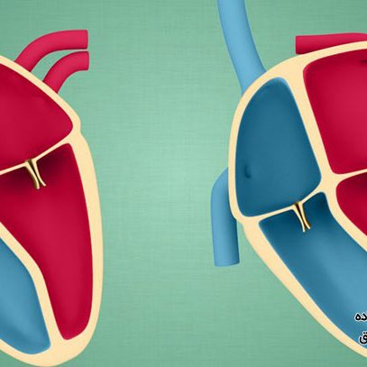 کاردیومیوپاتی چیست