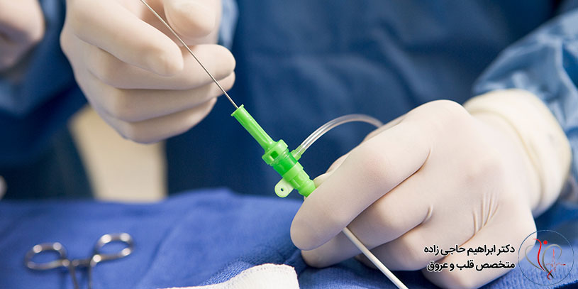 Hand-angiography-in-Tehran2 آنژیوگرافی قلب از طریق دست در تهران