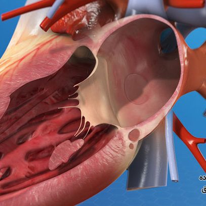 مراقبت های بعد از والووپلاستی