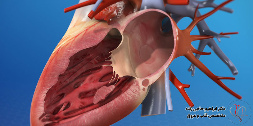 مراقبت های بعد از والووپلاستی