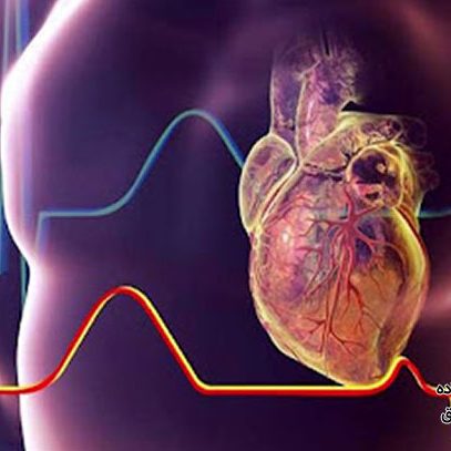 بیماری ماسل بریج چیست