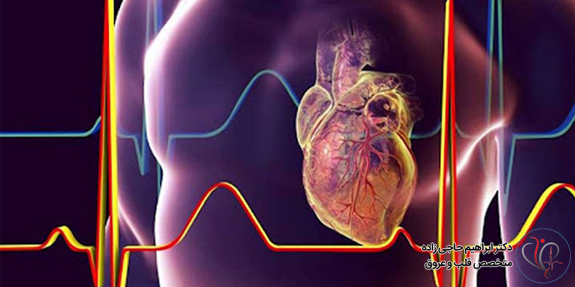 بیماری ماسل بریج چیست