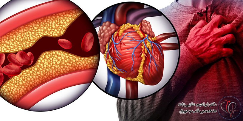 آنژین قلبی چیست