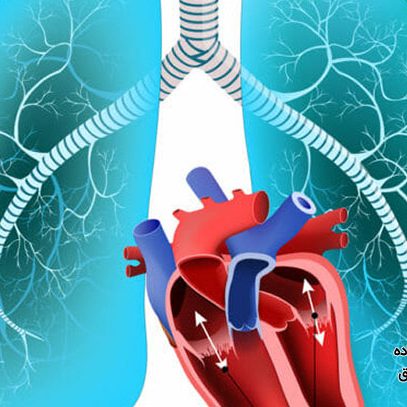 خطر فشار خون ریوی