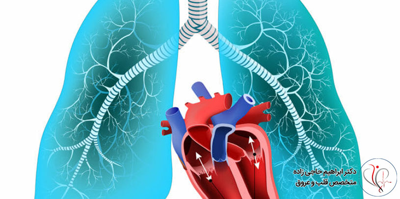 خطر فشار خون ریوی