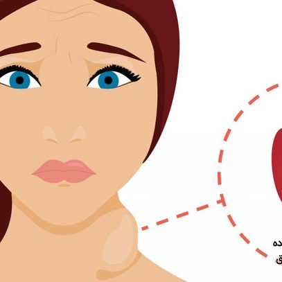 خطرات پرکاری تیروئید