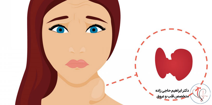 خطرات پرکاری تیروئید