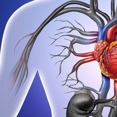 دایسکشن آئورت چیست