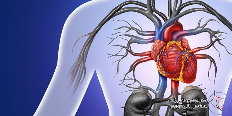 What-is-aortic-dissection4 دایسکشن آئورت چیست