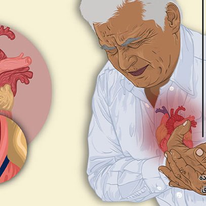 اسپاسم عروق کرونری قلب چیست