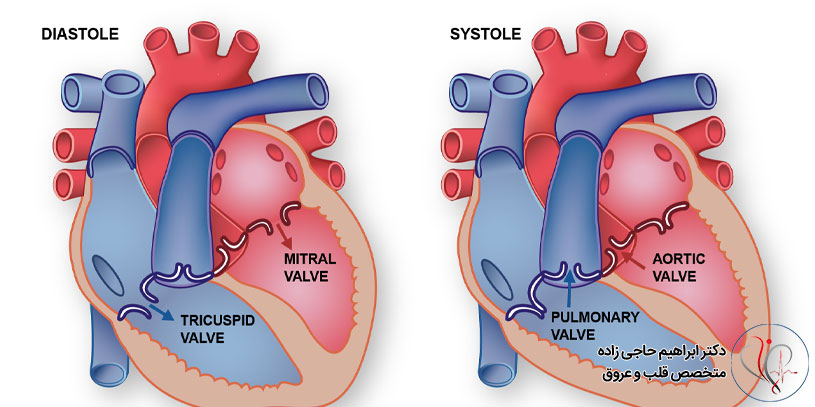 Symptoms-and-causes-of-aortic-valve-insufficiency2 علائم و علل نارسایی دریچه آئورت