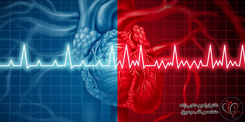 مهم ترین دلایل بروز آریتمی قلب