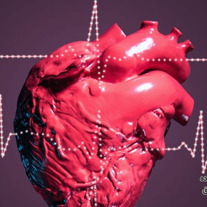 سندرم آیزن منگر چیست