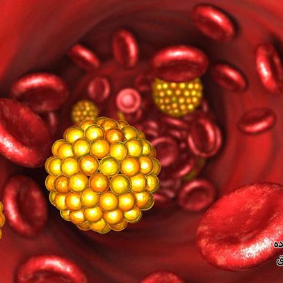 علائم چربی خون بالا در مردان و زنان