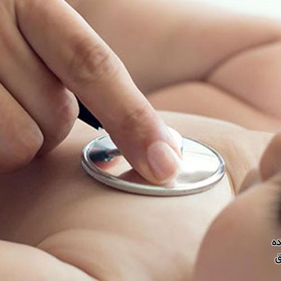 انواع مشکلات قلبی در بیماری سندروم داون