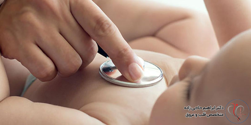 انواع مشکلات قلبی در بیماری سندروم داون