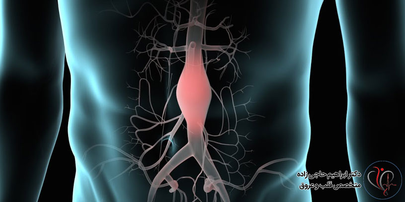 Abdominal-aortic-aneurysm-surgery3 جراحی آنوریسم آئورت شکمی