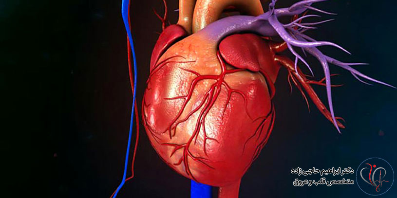 درباره دیسکسیون خودبخودی عروق کرونر